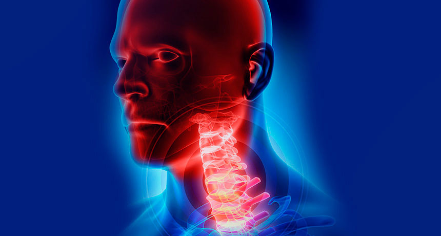Cáncer de cabeza y cuello, excluido el de tiroides