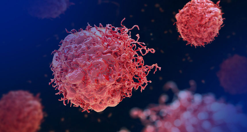 Tumores neuroendocrinos